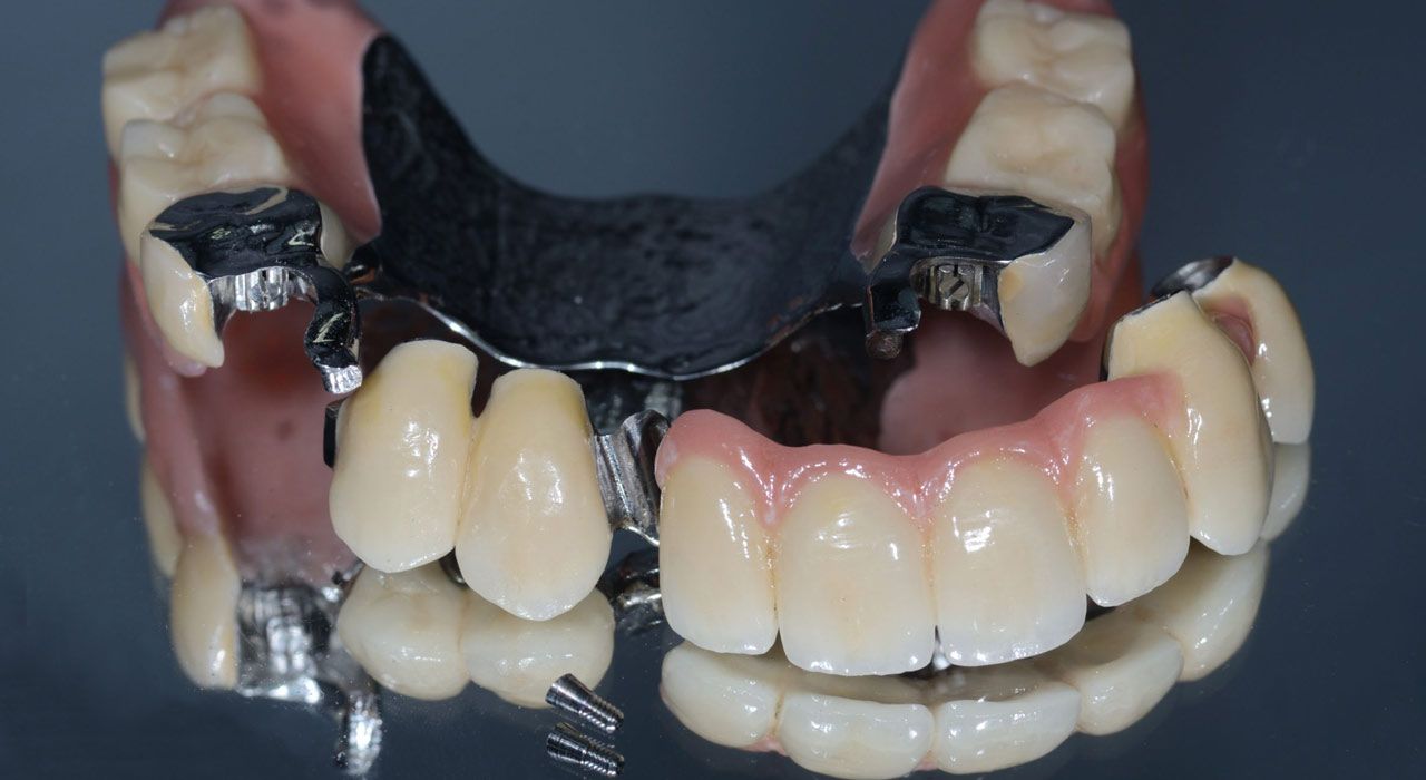 Kombinationsarbeiten