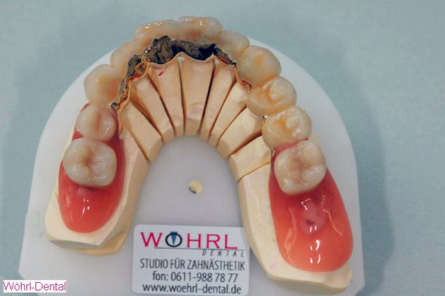 Wöhrl Dental Kombiarbeiten