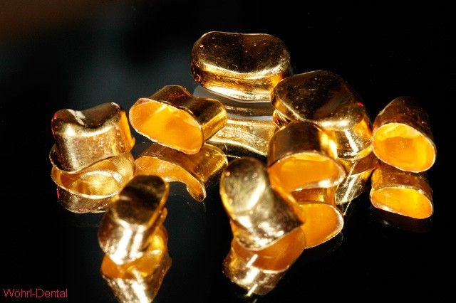 Wöhrl Dental herausnehmabre Brücken