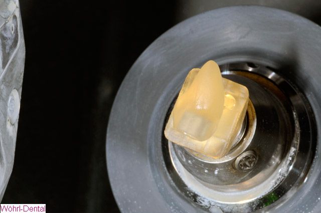Wöhrl Dental Implantate CAD CAM