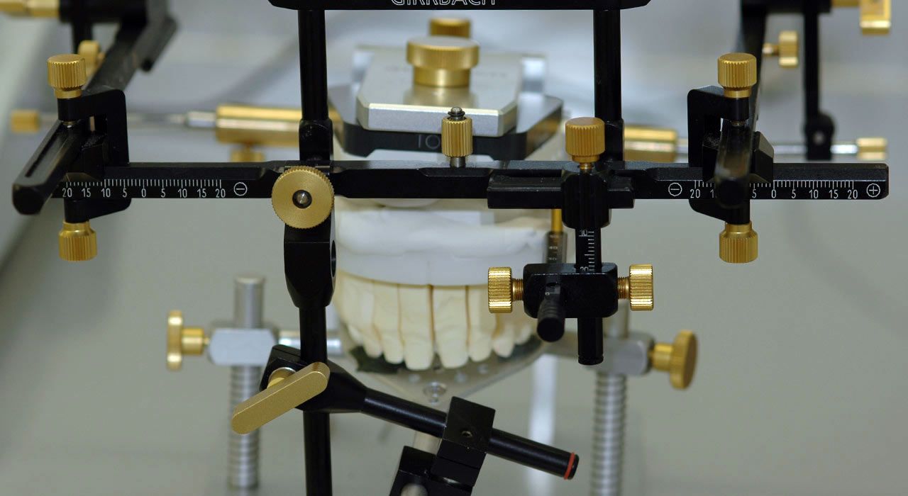 Funktionsorientierter Zahnersatz