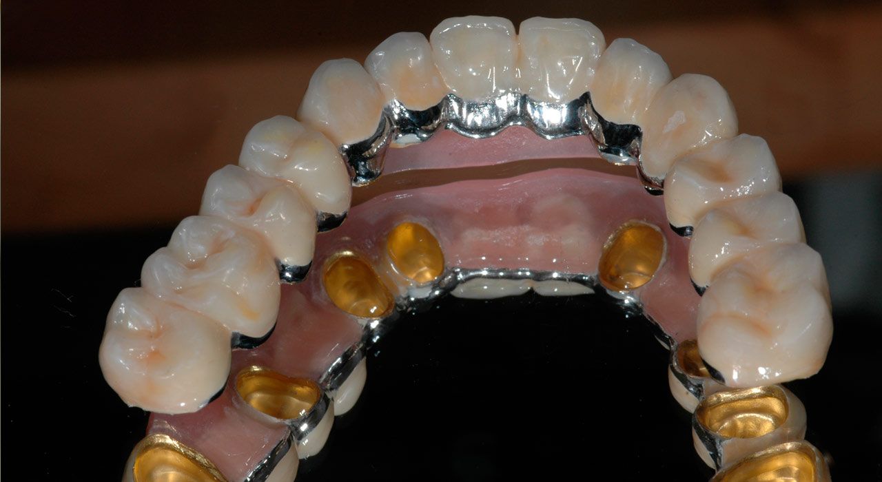 Einstückgussverfahren