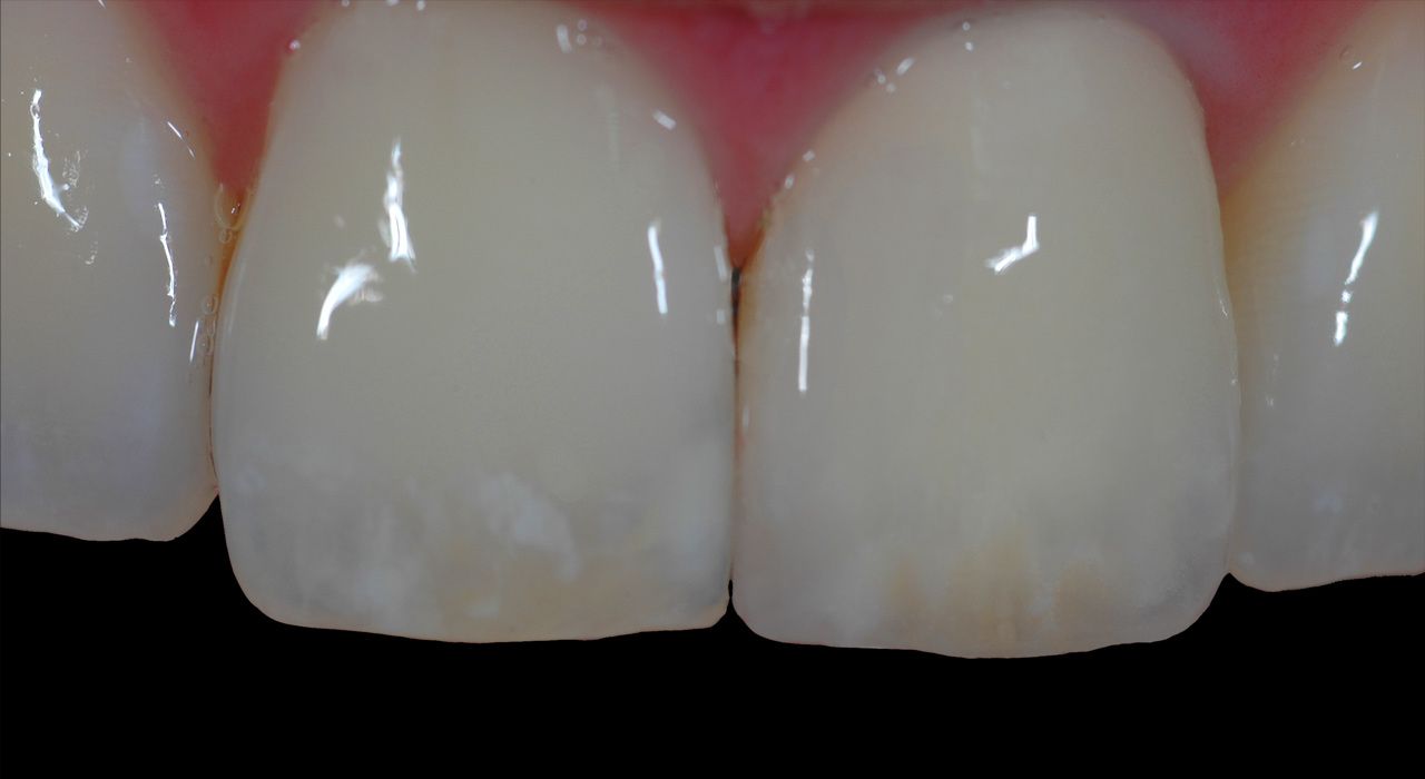 individuelle Farbanpassung